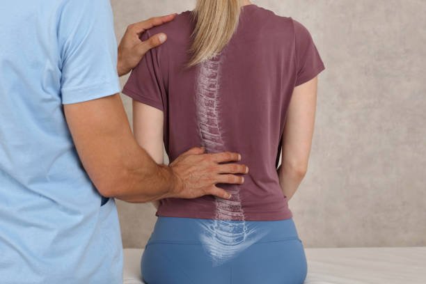 Posture Correction Islamabad - OKCURES